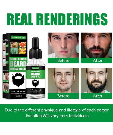 Best Cypreas Barthaar Growth Oil - 30ml Fast Thickening Beard Growth Amplifier for Men | Natural Facial Hair Growth - Buy Online on SooperMarket.com