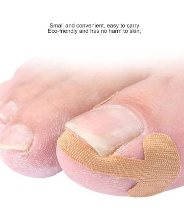 Ingrown Toenail Correction Sticker Adhesive Paronychia Straightening Patch Nail Corrector Bandage Easy Operation and Quality Material 20 Sheets for Foot Care - Buy Online on SooperMarket.com