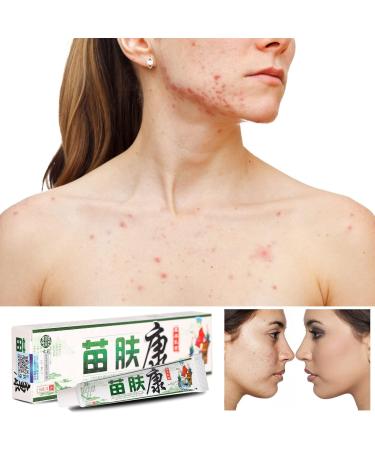 Herbal Anti-Itch Cream for Psoriasis, Dermatitis, Eczema - Multicolor, One Size - Buy Online on SooperMarket.com