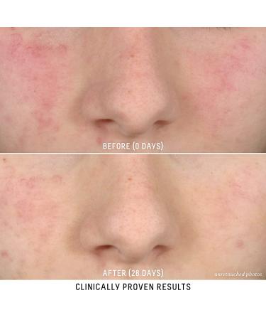 Biossance Squalane + Probiotic Gel Moisturizer - Gentle Formula for Calming Redness, Rosacea, and Pores - 1.6 oz - Buy Online on SooperMarket.com