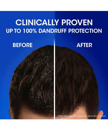 Buy Head & Shoulders Silky Black Anti-Dandruff Shampoo 340ml | International Shipping Available - Buy Online on SooperMarket.com