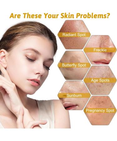 Niacinamide Face Serum 10% Niacinamide Serum + 1% Zinc Serum Face Moisturiser High Strength Vitamin Nourish Skincare Anti Aging Dark Spot Remover for Face Glow Skin Correcting (30ML) - Buy Online on SooperMarket.com