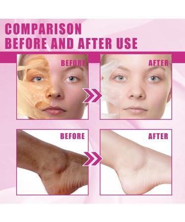 Exfoliant Yellow Peeling Oil - Extra Strong Chemical Exfoliant for Face & Body Reduces Rough Skin & Dullness Removes Dead Skin Cells - Buy Online on SooperMarket.com