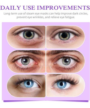 TIVLON Self Heating Eye Mask 24Pcs Steam Eye Mask Sleeping Eye Mask Eyestrain Relief Dry Eyes Disposable Moisturising Hot Compress Eye Mask Improves Sleep Quality Lavender Flavour - Buy Online on SooperMarket.com