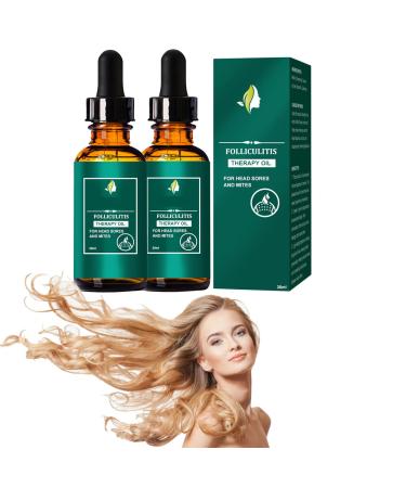 Nmbol Hair Growth Spray 2