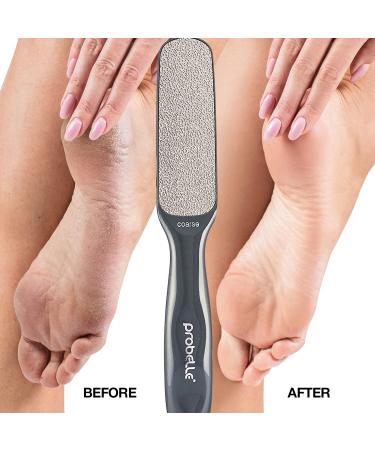 Probelle Double Sided Multidirectional Nickel Foot File Callus Remover - Instantly Reduce Calluses and Corns to Powder, Safe Tool (Dark Grey) - Buy Online on SooperMarket.com