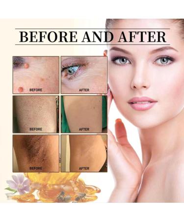 Shop 2024 Bee Venom Cream - Professional Correcting Gel for All Skin Types | 2 OZ - International Shipping Available - Buy Online on SooperMarket.com