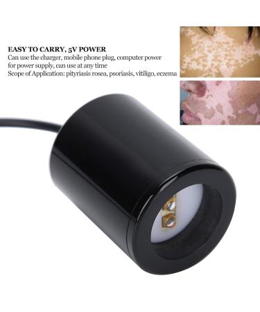 UV 308NM Vitiligo Physiotherapy Instrument for Psoriasis, Eczema & Pityriasis Rosea - Buy Online on SooperMarket.com