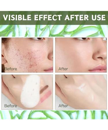Trendyfave Aloe Vera Gel Foaming Cleanser Face Wash Natural Acne Face Wash Built-In Silicone Cleaning Brush For Acne Prone & Oily Skin Exfoliating Face Wash - Soothe Purify Facial Skin Care - Buy Online on SooperMarket.com