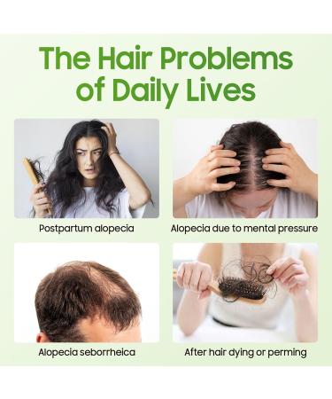 100% Pure Natural Rosemary Oil - Multipurpose Hair Oil for Growth Nourishing Scalp & Strengthening Hair - Buy Online on SooperMarket.com