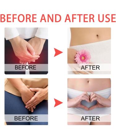 Saluaqui 3pcs Area Itch Ointment Gentle Itch Relief Cream for Women Intimate Care Long Lasting Refreshing Feminine Itch Treatment Cream for Health Care - Buy Online on SooperMarket.com