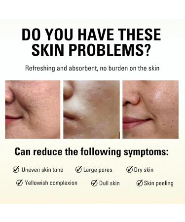 Glycolic Acid 7% Toning Solution Glycolic Acid Toner Hydrating Toner Glycolic Acid Serum Improve Blemishes&Acne and Spots Anti Aging Exfoliating Toner for Face Toner for Oily Skin 100ml - Buy Online on SooperMarket.com