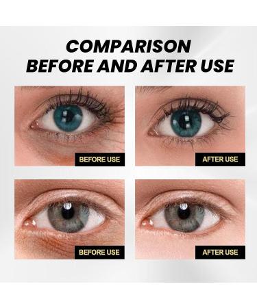 C lyn Instant Firmx Eye Tightener | Reduce Eye Bags & Puffiness | Anti-Aging Eye Cream for All Skin Types (2PCs) - Best International Shipping - Buy Online on SooperMarket.com