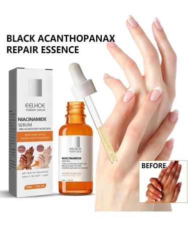 Niacinamide Serum Serum B5 Vitamin B3 Serum Anti-Wrinkle Serum for a Radiant Skin Tone and Minimised Pores Against the First Signs of Skin Ageing - Buy Online on SooperMarket.com