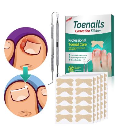 Ingrown Toenail Treatment-Ingrown Toenail Corrector Strips-Professional Safe Efficient-for Paronychia Caused by Ingrown Toenail-50 Pcs-with 2 Professional Pedicure tools 50 PCS