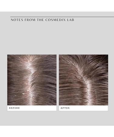 COSMEDIX Fortify Cooling Enzyme Scalp Treatment - Soothing Relief for Healthy Scalp | 1 ct | International Shipping Available - Buy Online on SooperMarket.com