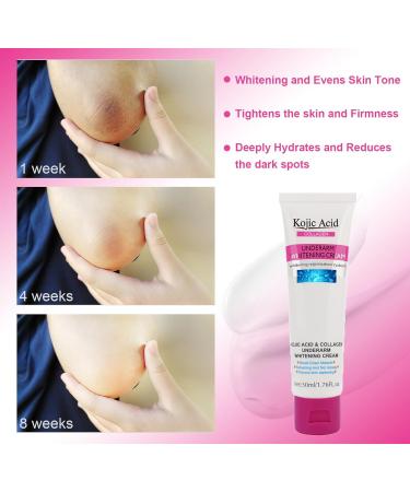 Kojic Acid Skin Whitening Cream for Intimate Areas | Dark Spot Corrector & Bleaching Cream for Body Underarms Knees Elbows | 1.7oz Collagen Milk Formula - Buy Online on SooperMarket.com