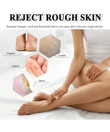 Urea 42% Foot Cream Cracked Heel Repair Cream For Feet and Hand Callus Remover For Dry And Hard Skin Hydrating Foot Moisterizer Nourishes Soften for Feet Knees Hand 100g - Buy Online on SooperMarket.com