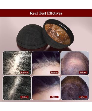 Jitesy Laser Therapy Cap - 236 Probes Red-Blue-Light Hair Growth System for Thinning Hair & Androgenetic Alopecia Treatment - Fast International Shipping - Buy Online on SooperMarket.com