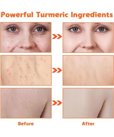 Turmeric Soap Bar Handmade Tumeric Soap Organic Turmeric Brightening Soap for All Skin Types Natural Soap for Cleansing Unclogs Pores Deep Cleaning - Buy Online on SooperMarket.com