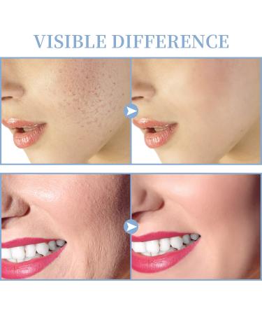 Portable High Frequency Facial Machine with 4 Tubes | TUMAKOU Skin Wand - Buy Online on SooperMarket.com
