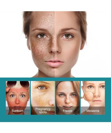 Fade Stain Beauty Cream Freckle Remover Cream Dark Spot Remover for Face Age Spot Remover Corrector Cream for Face and Body Dark Spot Remover Dark Spot Remover for Face and Body - Buy Online on SooperMarket.com