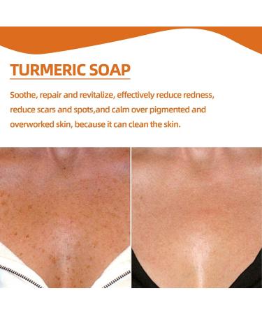 Nmbol Soap Cleansing Kojic Acid 3 - Buy Online on SooperMarket.com