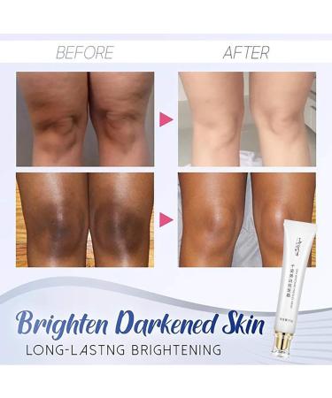 SnowySkin Legs Underarm Cream & Nose Strips Set - Instant Personal Skin Care | White | One Size - Buy Online on SooperMarket.com