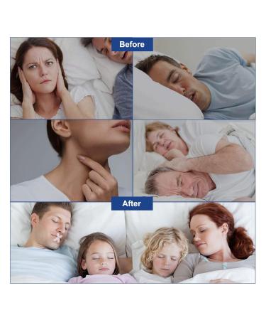 120pcs Anti Snoring Mouth Tape for Better Sleep and Reduced Snoring - Buy Online on SooperMarket.com