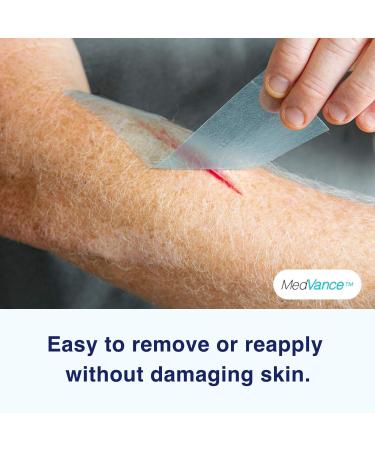 Medvance Soft Silicone Tape 1 Width - Perforated for Easy Cutting (1 Pack, 1.5 Yards) - Buy Online on SooperMarket.com