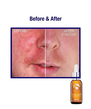 iS CLINICAL Pro-Heal Serum Advance+ 0.5 Fl Oz Yellow - Pack of 1 - Buy Online on SooperMarket.com