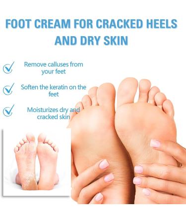 Foot Cream For Very Dry Feet Natural Foot Cream Foot Cream For Calluses And Hard Skin Cracked Heel Repair Balm Coconut Oil Foot Moisturiser Callus Remover Soften For Feet Knees Hand - 50g - Buy Online on SooperMarket.com
