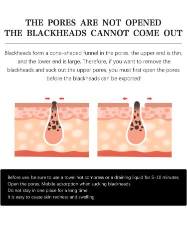 10pcs Hydrocolloid Blackhead Removal Patches | Deep Cleansing Pore Strips for Face, Nose, and Pores | Dermatologist Approved | Overnight Use - Buy Online on SooperMarket.com