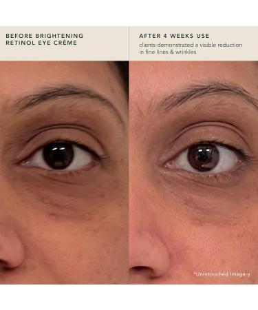 RANAVAT Brightening Retinol Eye Cream - Anti-Aging Dark Circle Corrector with Bakuchi Seed & Saffron | 0.5 oz International Shipping Available - Buy Online on SooperMarket.com