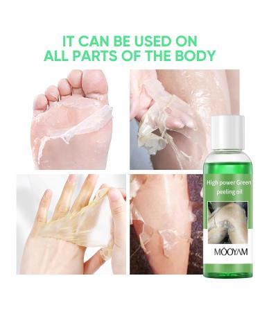 Extra Strength Peeling Oil for Dark Skin | Exfoliate Hands & Feet | Chemical Peel Solution - Buy Online on SooperMarket.com