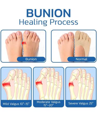 Projoint Antibunions Health Socks - Bunion Relief and Gout Relief - Orthopedic Toe Compression Socks (10PCS Black+Skin) - Buy Online on SooperMarket.com