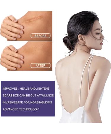Moisturizing Scar Gel Tape: Caesarean Scar Removal Strips - Buy Online on SooperMarket.com
