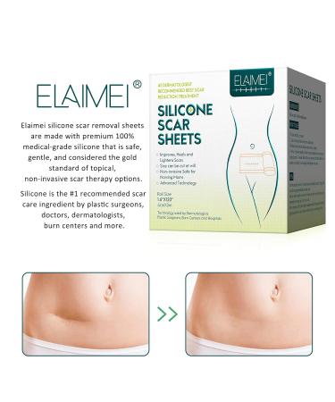 Keloid Bump Removal Silicone Gel Scar Remover Pen - Clear Outdoor Man Skin Care - One Size - Buy Online on SooperMarket.com