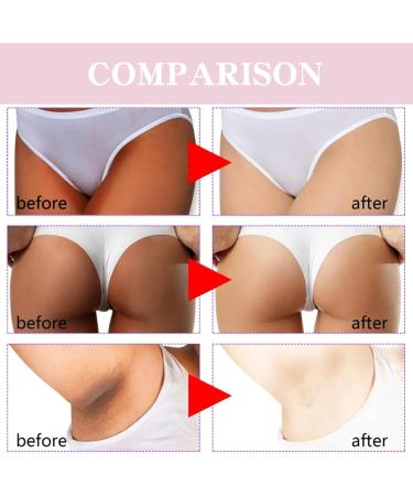 Intimate Skin Lightening Gel Underarm Cream Skin Brightening Cream Corrector Dark Spot Even Out Skin Tone For Intimate Parts Private Areas Body Knees Underarm Elbows Body Parts Brightening - Buy Online on SooperMarket.com