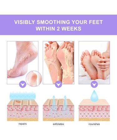 Exfoliating Foot Mask 4 Pairs Moisturizes Nourishes Foot Peel Mask Natural Ingredients Peel Away Hard Skin Calluses Renew Skin Repair And Soften Cracked Heels Feet Masks Exfoliating Socks - Buy Online on SooperMarket.com