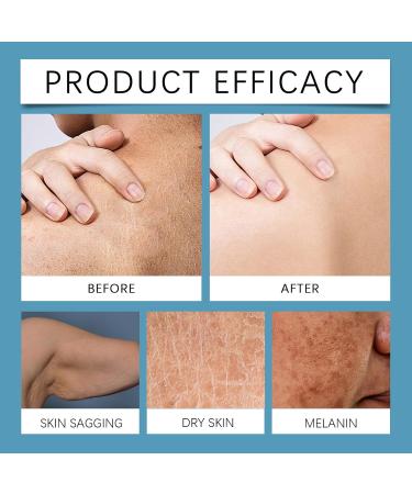 Collagen Lift Body Cream Collagen Skin Tightening Cream Firming Body Cream Collagen Moisturizer Body Moisturizer Skin Tightening Cream For Body Firms & Tightens For Younger Looking Skin 30g - Buy Online on SooperMarket.com