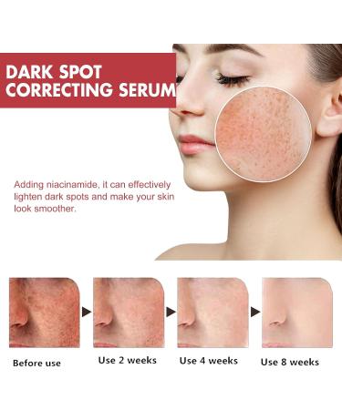 Dark Spot Correcting Serum Peach 70% Niacinamide Serum for Acne Scars Post-Acne Marks Korean Skincare Set for Teenagers Adult - Buy Online on SooperMarket.com