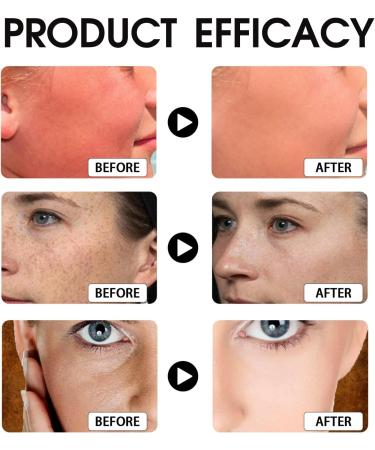 Hyaluronic Acid Sunscreen SPF 50+ PA+++ Sun Cream SPF 50 Face Sunscreen SPF 50 High Protection Face Sun Cream Moisturizing Refreshing Travel Size Sun Cream Against Sunburn Non-Greasy - Buy Online on SooperMarket.com