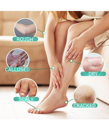 Urea Foot Cream Foot Cream for Cracked Heels and Dry Skin Cracked Heel Repair Cream Callus Remover Foot Moisturiser Natural Moisturizes Nourishes Softens Hand & Feet Care - Buy Online on SooperMarket.com