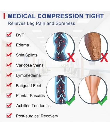 Beister Medical Compression Stockings for Women & Men | 20-30 mmHg Support | Opaque Toe Wrap for Varicose Veins & Edema - Class 2 Size L - Buy Online on SooperMarket.com