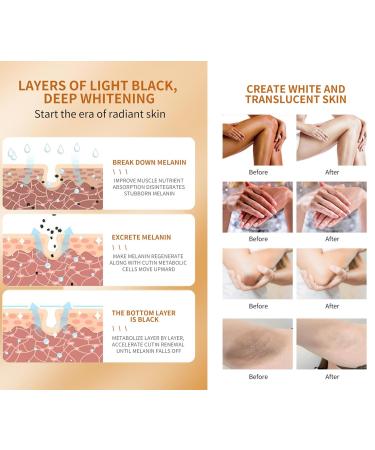 Skin Whitening Cream | Armpit & Underarm Lightening | Dark Spot Corrector for Body | 2oz Intimate Area Bleaching Solution - Buy Online on SooperMarket.com
