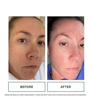 Replenix Discoloration Essentials 3 Step Brightening Trial Kit - Travel-Size Glycolic Acid Cream Vitamin C Serum & Brightening Eye Cream for Radiant Skin - Buy Online on SooperMarket.com