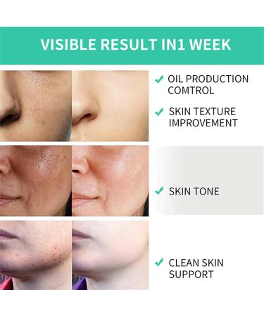 Glycolic Acid Peel Pads - 35% Exfoliating Wipes for Face & Body | Vitamin B5 & Tea Tree Oil | Minimize Pores & Uneven Skin Tone (2 Pcs 2.82oz) - International Shipping - Buy Online on SooperMarket.com