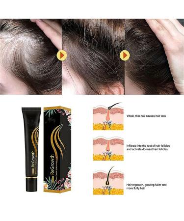 Regrowth Organic Hair Serum Roller Set - Intense Roll-On Hair Growth for All Hair Types (3PCs) | Men & Women - Buy Online on SooperMarket.com