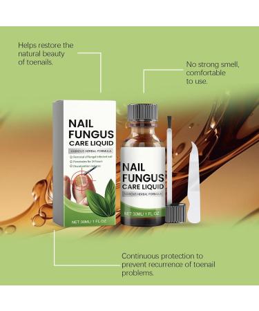 Nail Nourishing Solution | Multifunctional Nail Repair Drops | Nail Strengthening Drops | Hydrating Nail | Natural Nail Repair Remedy |-Infused Nail - Buy Online on SooperMarket.com